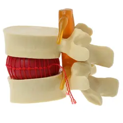 Анатомические спина поясница грыжа диска анатомический медицинский обучающий инструмент