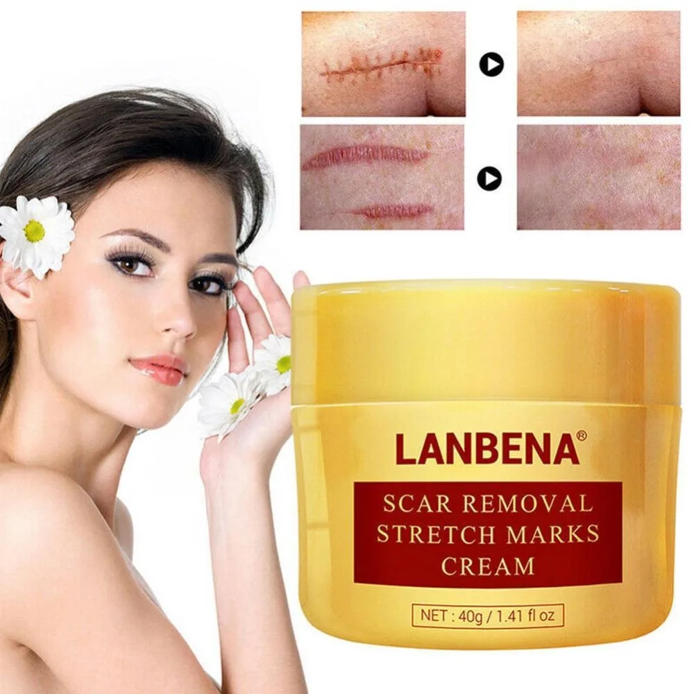 LANBENA, 40 г, крем для удаления шрамов, лечение акне, восстановление шрамов и черных точек, сужение пор, отбеливание, увлажняющий уход за кожей