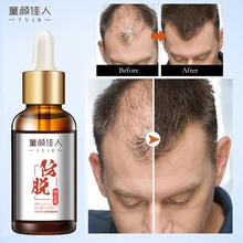 Suero para el cuidado del cabello, suero para el cuidado de la renovación del cabello, líquido de crecimiento rápido, tratamiento dañado de reparación de cabello grueso, esencia de cultivo de raíces de cabello seco y rugoso