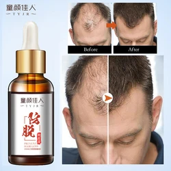 Anti-Loss Hair Renewal Care Serum Liquid Fast Growth Hair Thick Hair Repair Damaged Treatment Dry Rough Hair Root Grow Essence