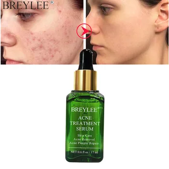 BREYLEE-suero Facial para el tratamiento del acné, árbol del té, elimina las marcas del acné, cicatrices, reduce los poros, blanqueamiento, esencia hidratante para el rostro, 17ml