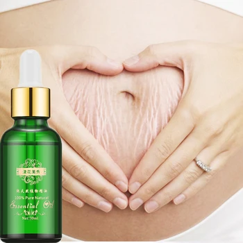 

Stretch Marks Remover Essential Oil Skin Care Treatment Cream For Stretch Mark Removal Maternity Slackline For Pregnant Oils