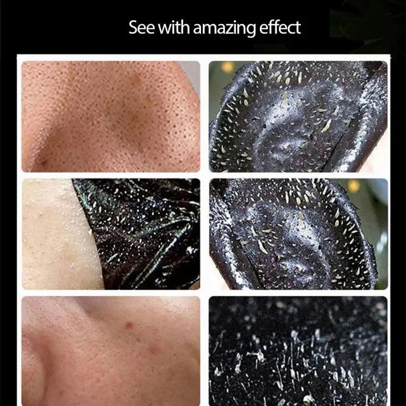 пилинг для расширенных пор. очищение кожи прыщей. скраб для лица на лице. отшелушивание кожи лица. очищение кожи прыщей.