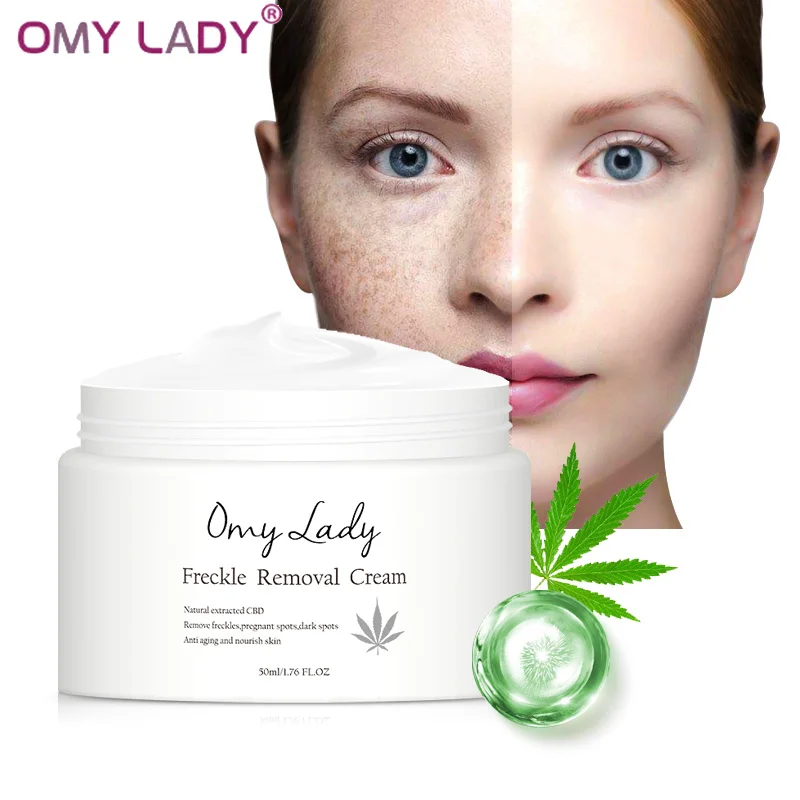 Freckle-Removal-Cream Whitening Remove-Freckle Melanin Dark-Spot Anti-Aging Omy Lady