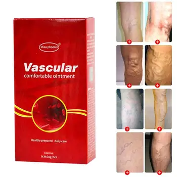 

Varicose Veins Treatment Cream Ointment Vasculitis Phlebitis Spider Veins Pain Varicosity Angiitis Remedy Removal Herbal Cream