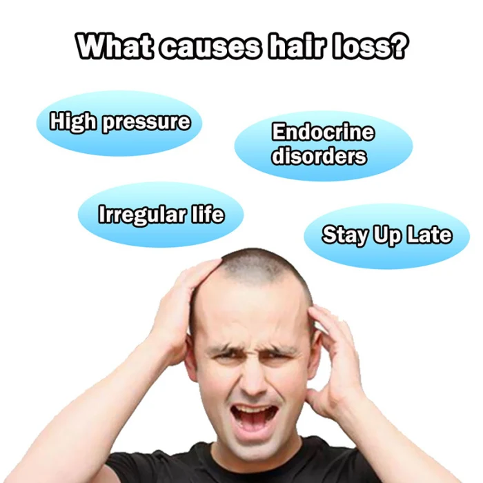 Hair Loss Treatment Regrow Liquid Care Protect from Dandruff for Women Men JS11