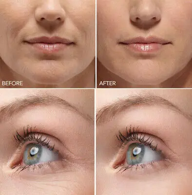 

Hyaluronic Acid Gel Cream - Anti-Aging Wrinkle Face & Eye (HA) Serum Moisturizer