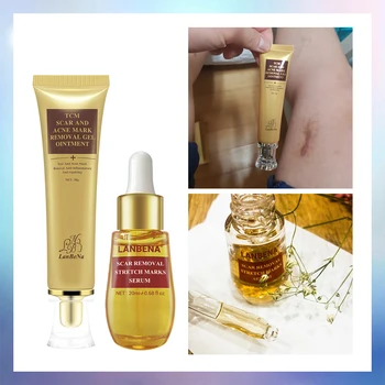 

Acne Scar Remove Serum Acne Treatment Cream Skin Repair Stretch Marks Anti Acne Shrink Pores Moisturize2PCS