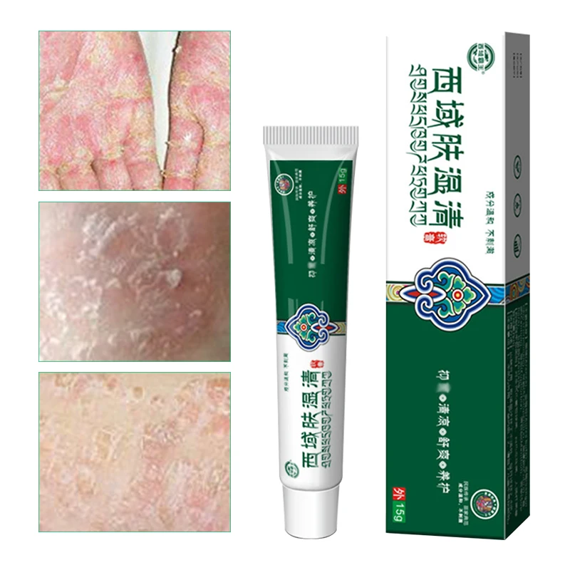 

Anti-itching Cream Eczema Ointment Skin Pruritus Treatment Plaster Chinese Medicine Antibacterial Cream Natural Herbal Ointment