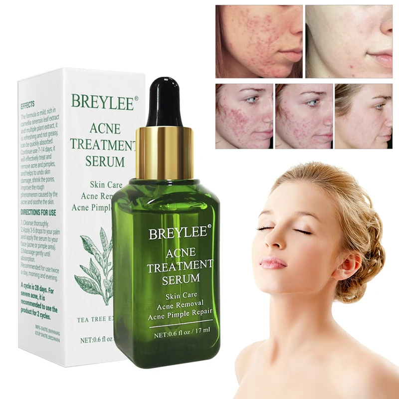 1 PC BREYLEE Acne Treatment Serum Face Facial Anti Acne Scar Removal Cream Skin Care Whitening Repair Pimple TSLM1