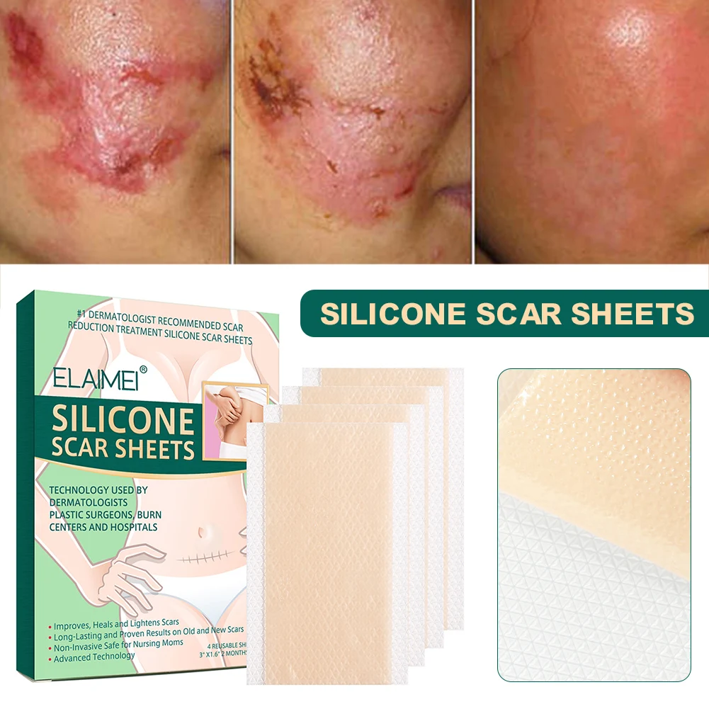 Силиконовые листы для удаления шрамов смягчающие и сплющивающие шрамы при