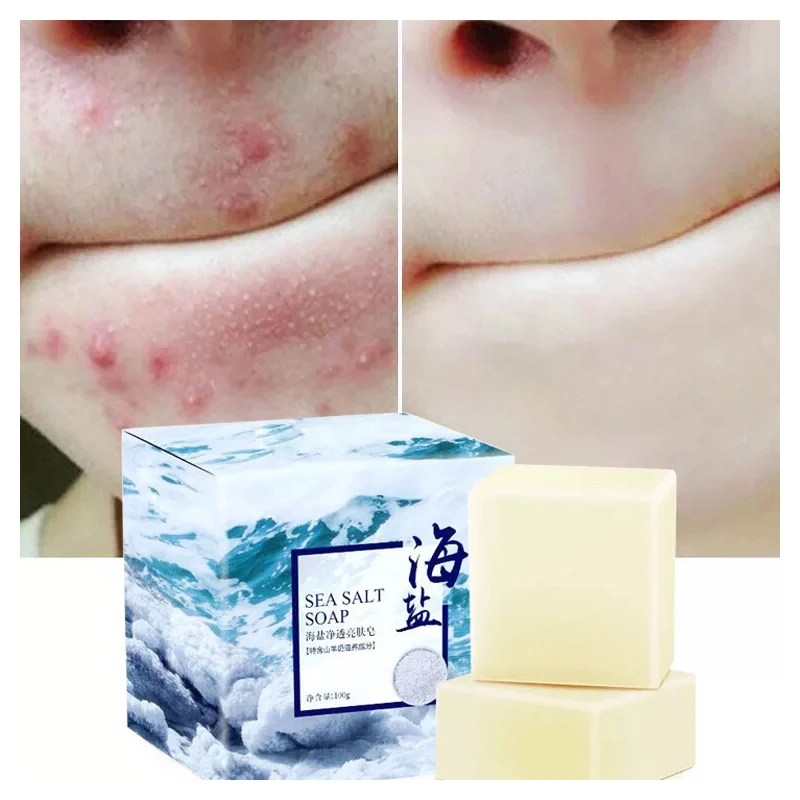 Removal Pimple Pore Acne Treatment Sea Salt Soap Cleaner Moisturizing Oil-Control Goat Milk Soap Face Care Wash Basis Soaps100g