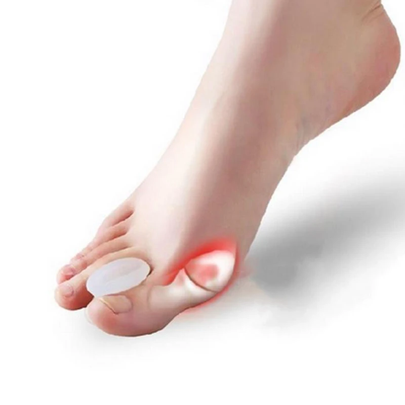 2Pcs Bone Thumb Valgus Protector Silicone Foot Finger Toe Separator Bunion Adjuster Hallux Valgus Pedicure Corrector Feet Care