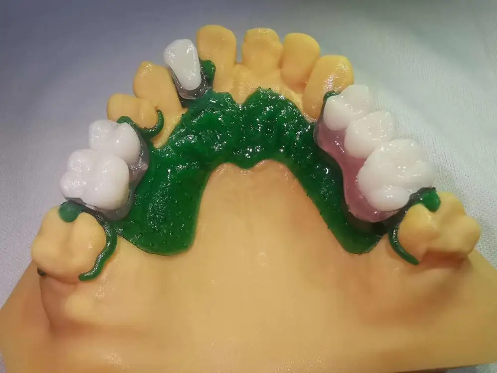 의치 베이스 임시 치아 감광성 수지 3D 프린터 흡착 옥타라이트 샤이닝 NOVA3D 1000ML, 405nm, 무료 배송
