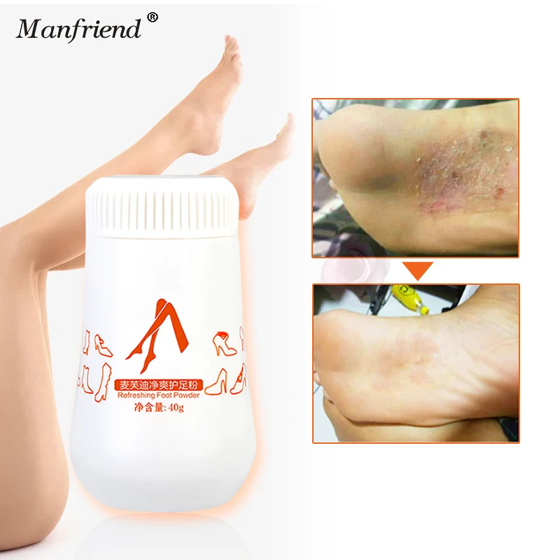 Smelly Feet Repair Peculiar Smell Powder Plantar Fungal Infections Shoes Care Dry Salicylic Acid Foot Portable 40g | Красота и