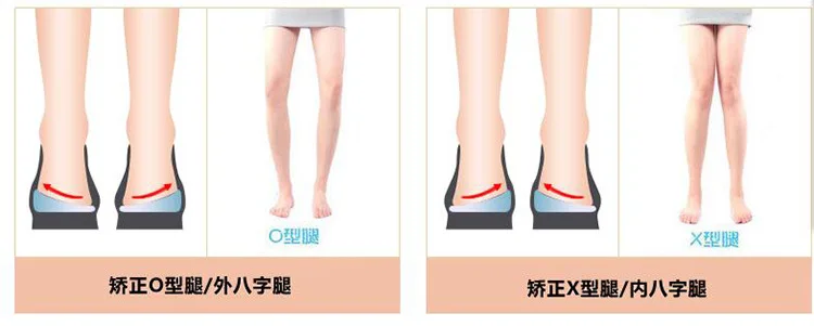 Вальгусная и варусная деформация. Вальгусная деформация ног genu varum. Вальгус и варус коленных суставов. Варусная вальгусная стопа у ребенка. Вальгус коленных суставов у взрослых.