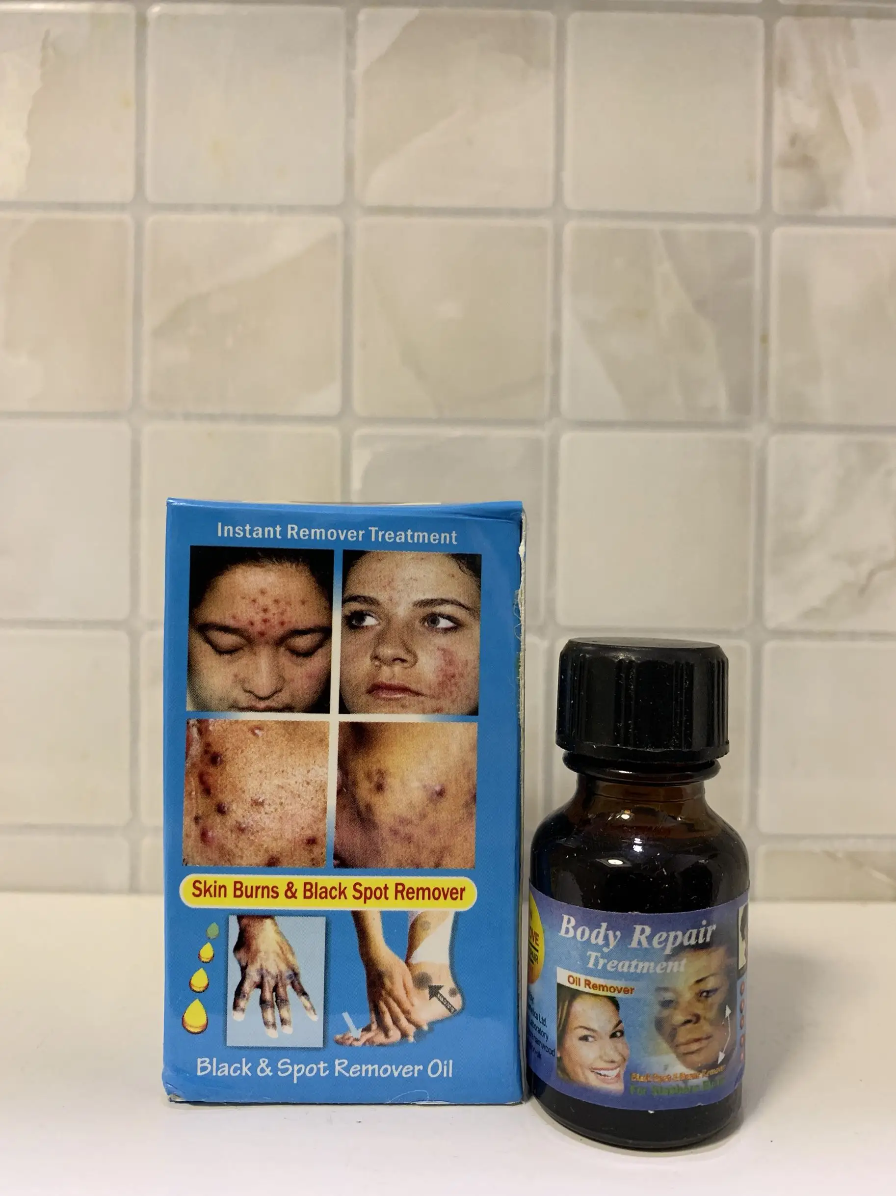 

New Body Repair Treatment | Oil Spot Remover knuckle | AFRIWORLD