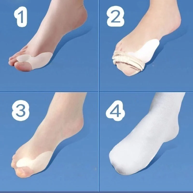 2pcs Silicone Gel Bunion Protector Toe Straightener Separator Pad Correctors