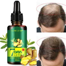 7 dias gengibre crescimento do cabelo produto masculino feminino crescimento do cabelo germinal soro óleo anti queda de cabelo spray rápido crescer reparação tratamento do cabelo