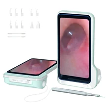 

P50 Smart wifi with screen Otoscope 5 million HD visual ear pick Luminous ear pick Children visual ear pick 3.9mm 1080P