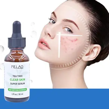 

30ml TeaTree Face Serum Repair Acne Treatment Serum Scar Oil Control Moisturizing Shrink Pore Face Skin Care