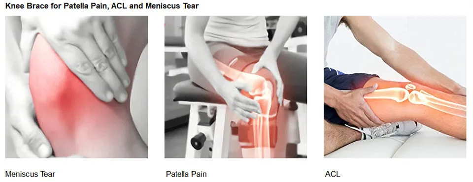 1 шт. фиксатор колена для мужчин iscus Tear, артрит, ACL, LCL, MCL восстановление травм, бег, Велоспорт, Баскетбол с Patella стабилизатор для мужчин и женщин с регулируемой обвязкой и дышащим коленом