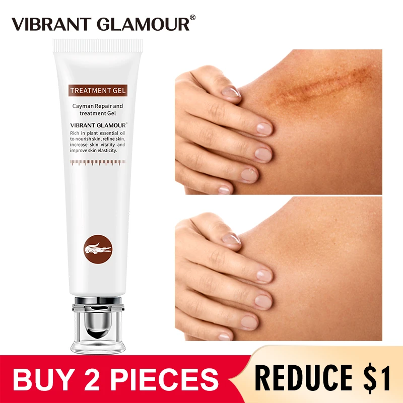 crocodile scar cream