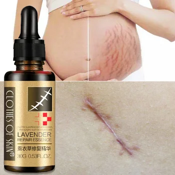 

30g Against Black Dots Cream Scar Removal Body Cream Blackhead Acne Skin Care Treatment Skin Moisturizer