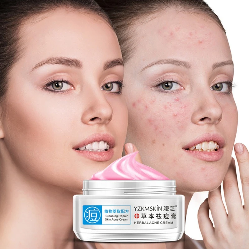 face stains cream