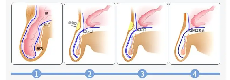 360截图20200424204536321