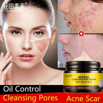 

WATIANMPH Herbs cream Anti Acne Scar Face Cream Oil-control Repair acne cream face care Whitening cream 30g