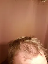 Esencia De rápido crecimiento De pelo, productos Para la pérdida del cabello, Fibras Para el crecimiento del cabello, champú, crema De tratamiento Para el cuidado del cabello