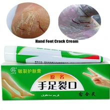 2 шт./партия крем от трещин пятки рук, шелушение исцеление, анти сухой трещин, зимние Уход за ногами, китайский лечебный крем для мази
