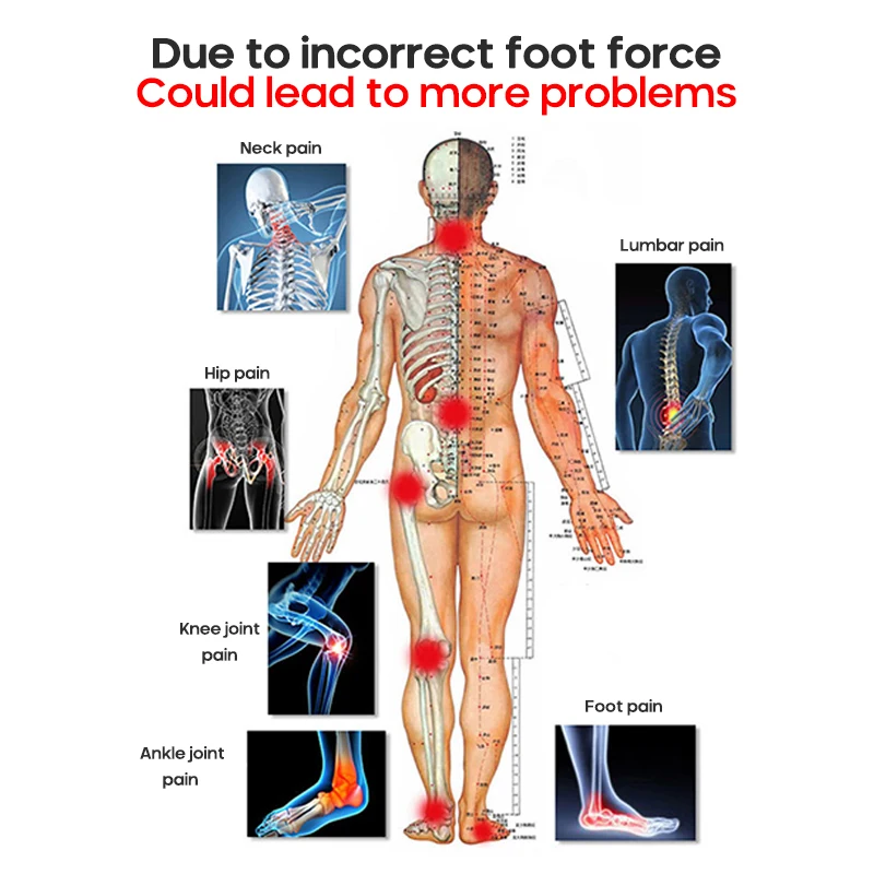 Arch Support For Flat Feet