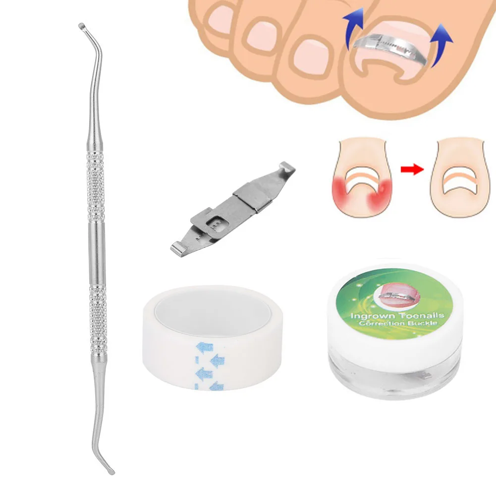 3pcs Ingrown Toenail Corrector Paronychia Treatment Nail Correction Buckle Adhesive Tape Set Ingrown Toenail Correctors