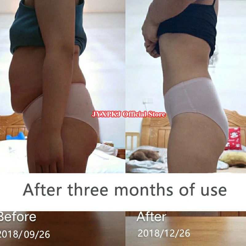 Original Slimming Weight Loss Diet Pills Reduce Capsule Rejected Cellulite Fat Burning Burner Lose Weight Reduc Aid Emagrecime Original Slimming Weight Loss Diet Pills Reduce Capsule Rejected Cellulite Fat Burning Burner Lose Weight Reduc Aid Emagrecime