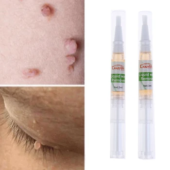 

2Pcs High Quality 5 Days Skin Tag Remover Pen Natural Health Mole Nevus Wart Skin Tag Removal