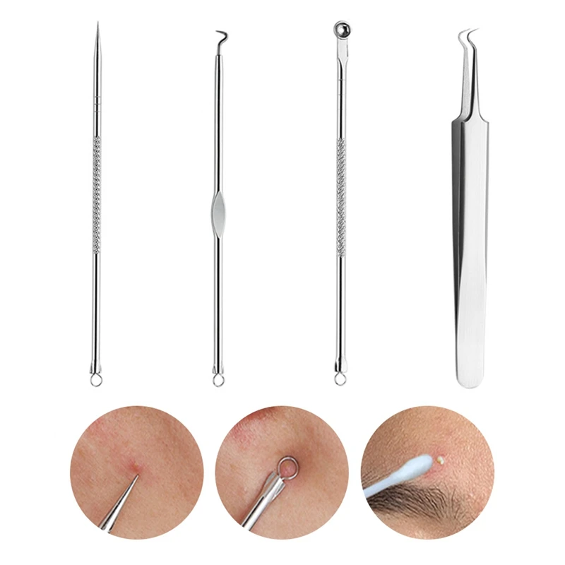 Fast Sending Lady Stainless Steel Blackhead Acne Blemish Pimple Extractor Remover Needle Drop Shipping