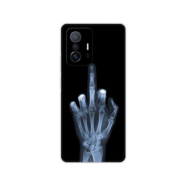 Xiaomi 11T Case For Xiaomi 11T Pro Soft Case Silicon Phone Back Cover For Xiaomi11T mi 11 T 11TPro coque 6.67inch bumper TPU