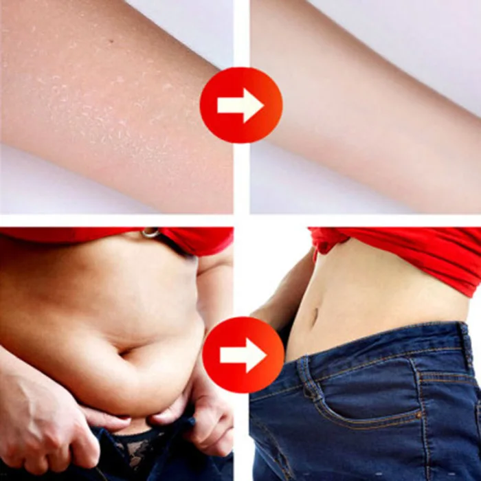 Body Fat Loss Massage Essential Oil Weight Loss Promote Fat Burn Thin Waist Skin Care Treatment 10ml Ws99 Slimming Product Aliexpress