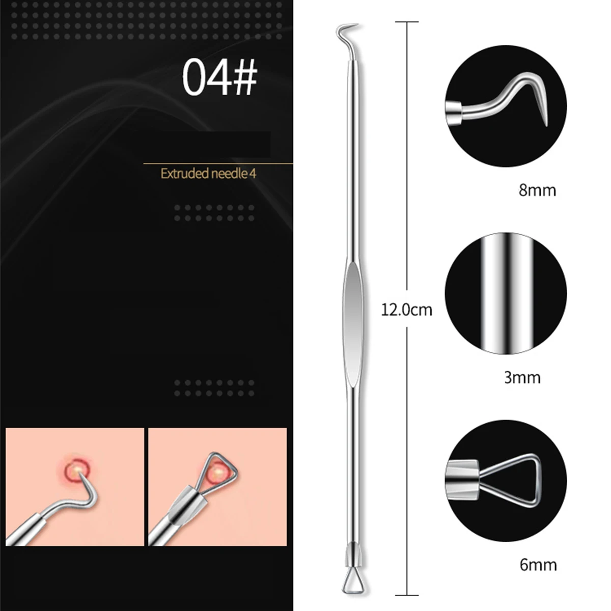 4PCS Acne Blackhead Comedone Black Spot Pimple Blemish Remover Skin Care Women Beauty Acne Treatment Pore Cleanser Needle Hook 5
