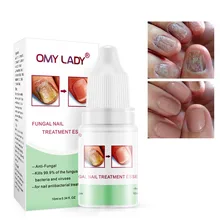 10 мл восстанавливающая жидкость для ногтей, эффективная против грибка ногтей, сыворотка для удаления онихомикоза, Лечение ногтей, Прямая поставка, поддержка MKXJ