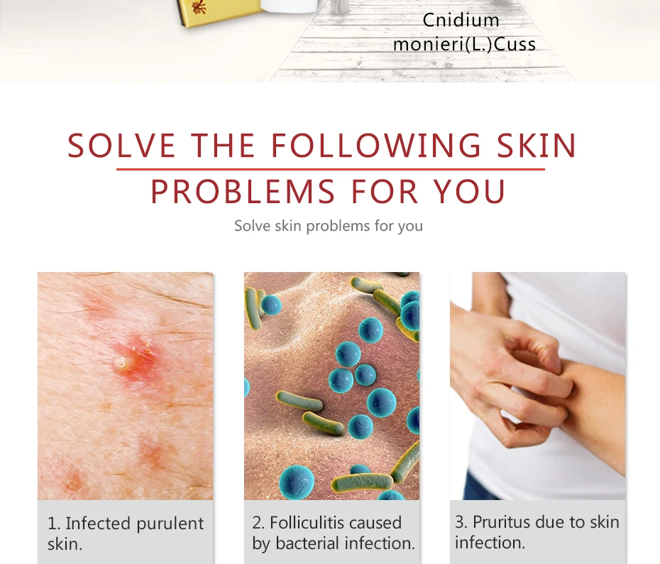 Pifubaodian мазь от псориаза оригинальный псориаз дерматит Eczema Pruritus проблемы с кожей