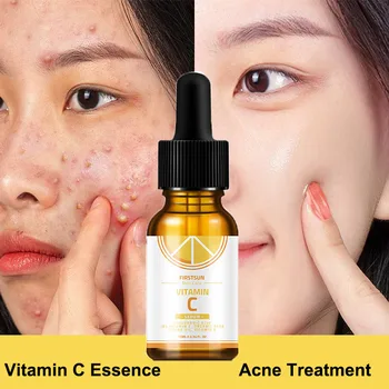 

Effective Vitamin C Face Essence Pimple Acne Treatment Anti-Aging Wrinkles Shrink Pore Whitening Smoothing Skin Care Serum 2020