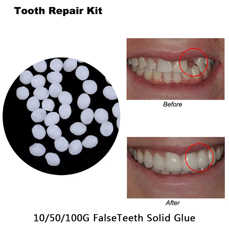 10g/50g/100g Temporary Tooth Repair Kit Teeth And Gaps FalseTeeth Solid Glue Denture Adhesive Teeth Whitening Tooth Beauty Tool