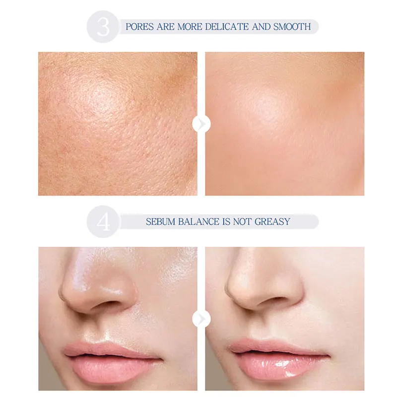 moisturiser after hyaluronic acid