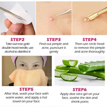 

4pcs/set Rose Gold Blackhead Pimple Needles Remover Treatment Acne Gold Remove Rose Kit Tool Needle Clean To Blemish Blackh L9Y9