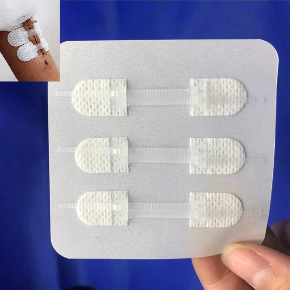 Стяжки для стягивания краёв резаных ран zipstitch. Зип-пластырь для армейской аптечки 3 шт. Зип пластырь. Зип пластырь. Стяжки для стягивания краёв резаных ран zipstitch.