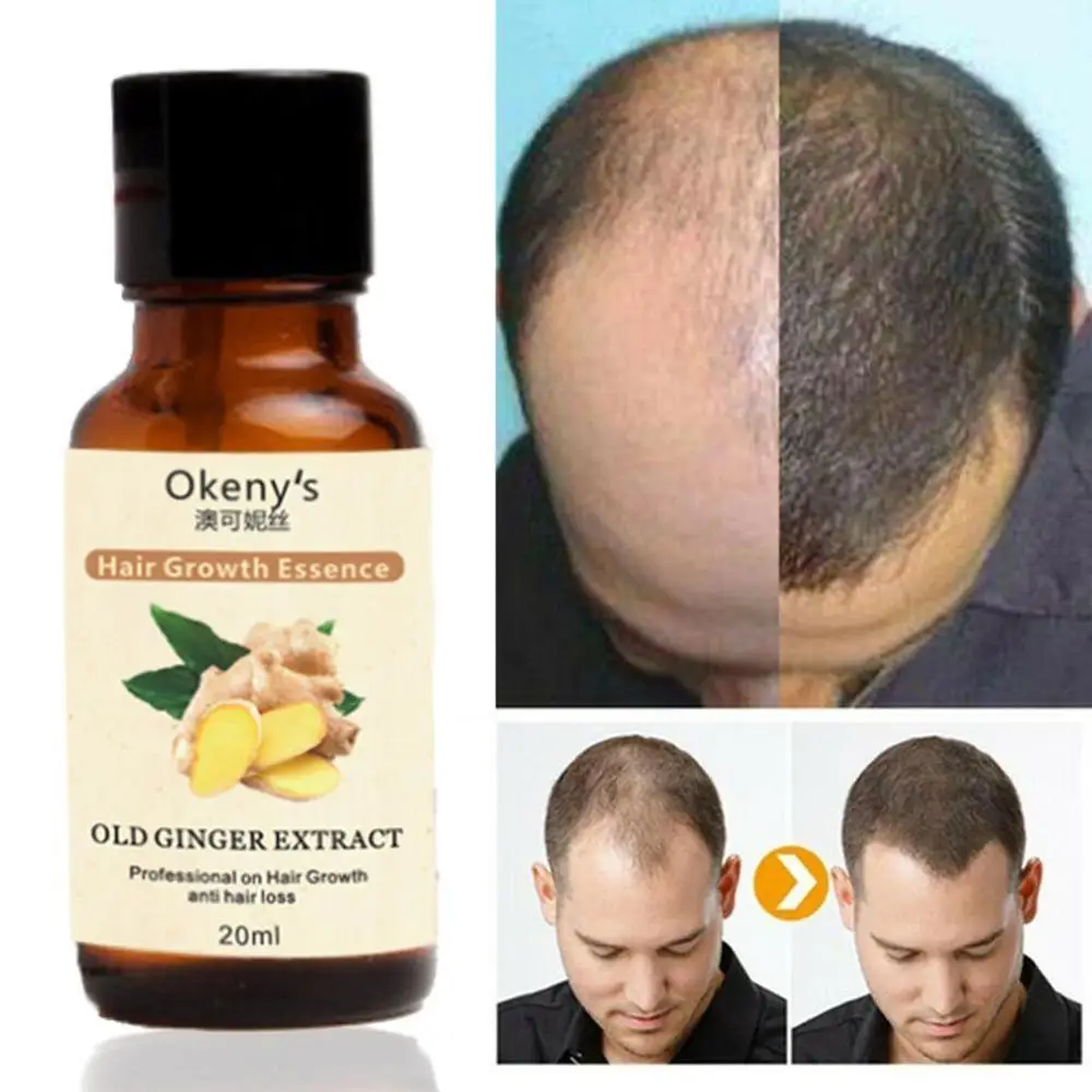 Hair Growth Loss Liquid 20ml Dense 1 Bottle Fast Organic Grow Restoration Pilatory | Красота и здоровье