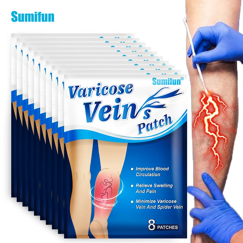 Пластырь для лечения варикозного расширения вен 80 шт. | Красота и здоровье